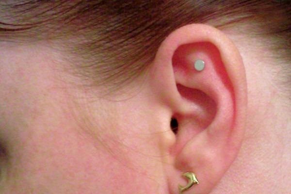 какие отзывы о магнитах на ухо для похудения оставляют девушки